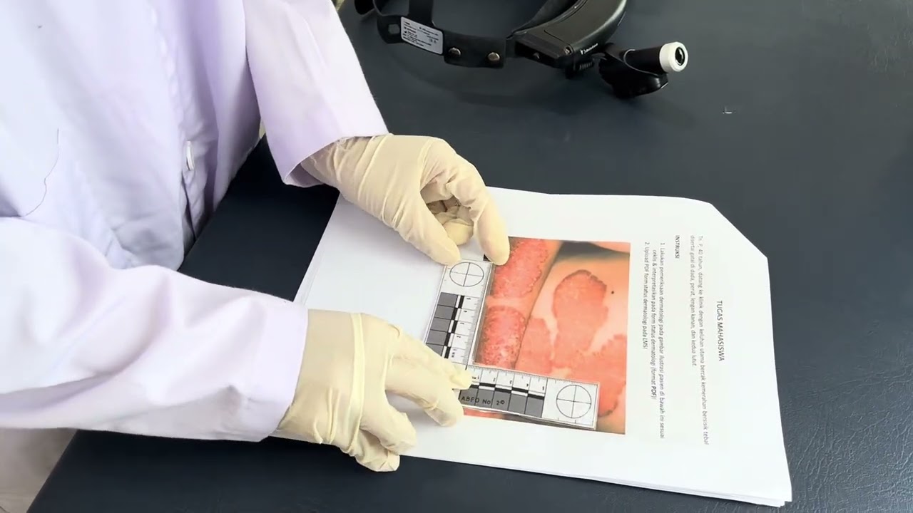 VIDEO ADEMS WEEK 2_Pemeriksaan Fisik Dermatologi_Rizki yudha iswara _250010038
