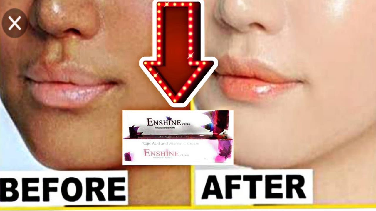 kojic acid and vitamin c cream uses in hindi