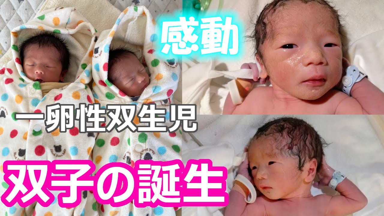 【双子出産】一卵性双生児の赤ちゃんが誕生 - YouTube