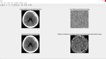 JOINT ENCRYPTION WATERMARKING SYSTEM USING AES AND RC4 FOR MEDICAL IMAGE