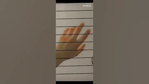 صور يد مجروحه كانها لك 
