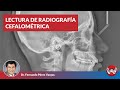 Lectura de Radiografía Cefalométrica