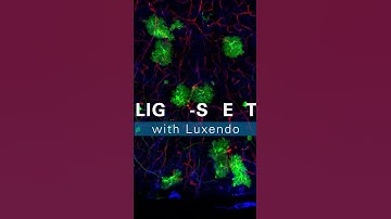 Live or cleared, the possibilities are endless with light-sheet technology 🔬💡 #neuroscience #brain