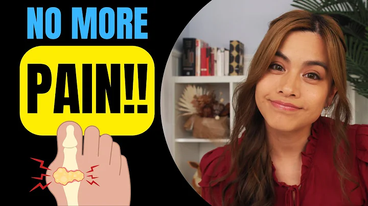 Gout Supplements - Top 4 Natural Ways To Stop Gout