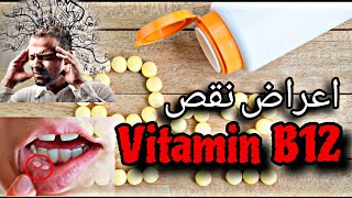 أعراض نقص فيتامين B12 ||الأكلات الغنيه B12