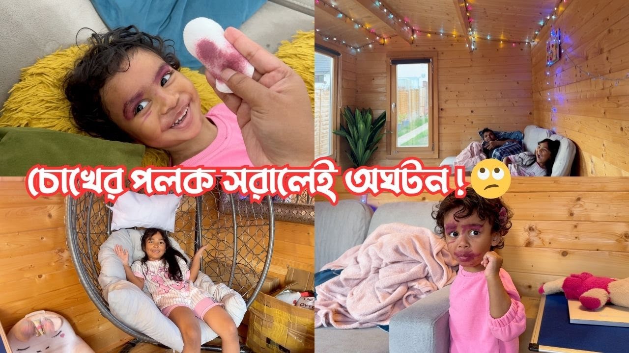 চোখের পলক সরালেই অঘটন! 🙄