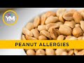 Is it time to end peanut bans in schools? | Your Morning