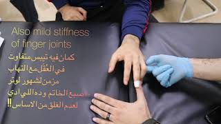 تيبس مع التهاب اصابع اليد قبل/بعد الجلسه👊🏽 ‏ @ELAGIعلاجي tendon injury for judo player pre/post