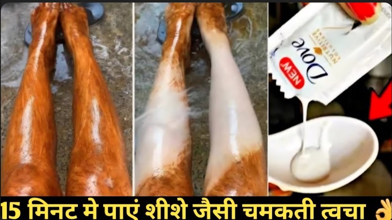 Просто смешайте это средство с шампунем и нанесите на кожу, и ваши руки и ноги станут молочно-бел...