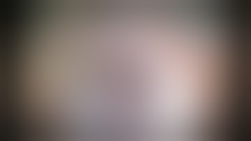 CataractCoach 1578: How to rescue this capsule split during cortex removal