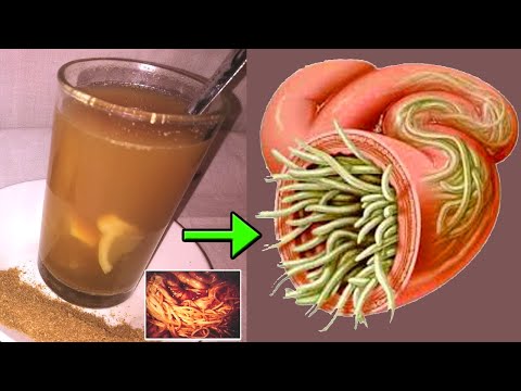 Get Rid Of Intestinal Worms In No Time! The Chinese medicine To Get rid of intestinal parasites