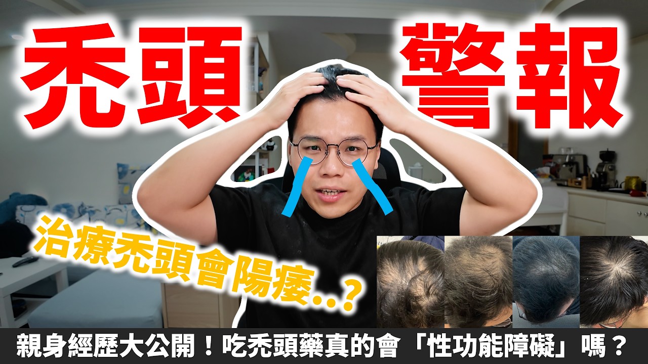 禿頭警報 別再騙自己啦! 吃藥治禿頭真的會影響「性功能」嗎? 縮圖
