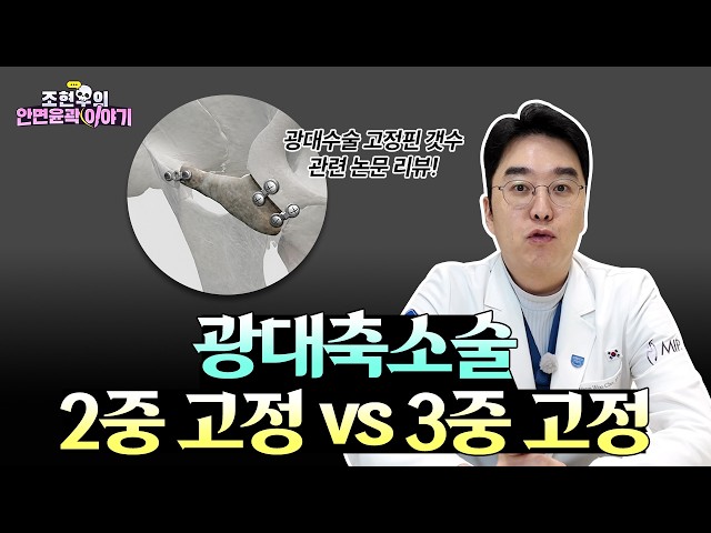 [논문 리뷰] 광대축소술 고정 많을수록 좋을까?｜2중고정 vs 3중고정