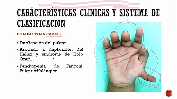 O que é a doença polidactilia?