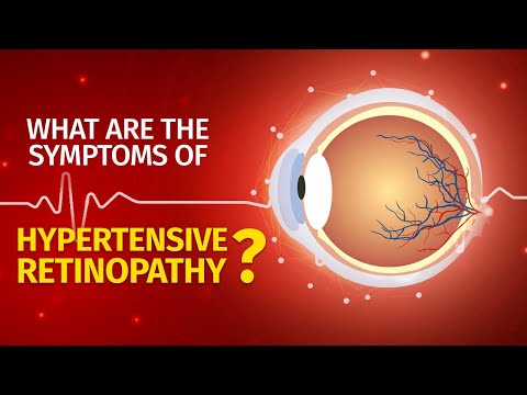 What are the symptoms of Hypertensive Retinopathy | Causes | Prevention