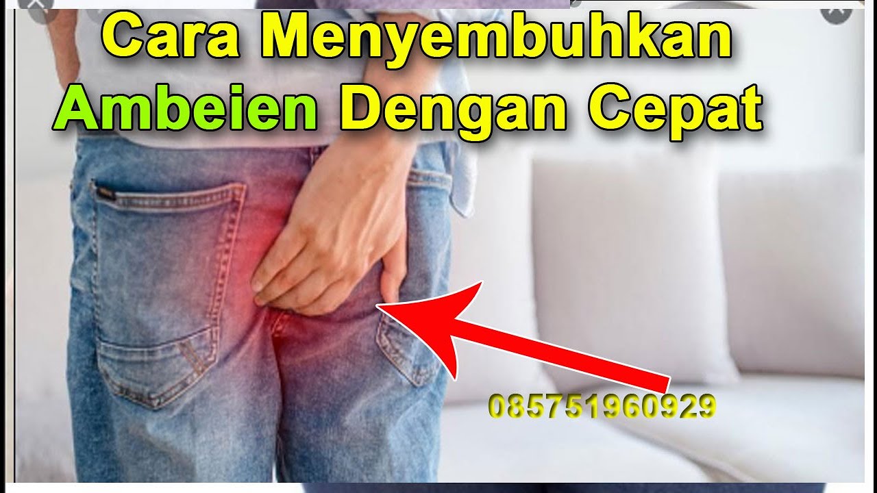 Cara Menyembuhkan Ambeien Dengan Cepat