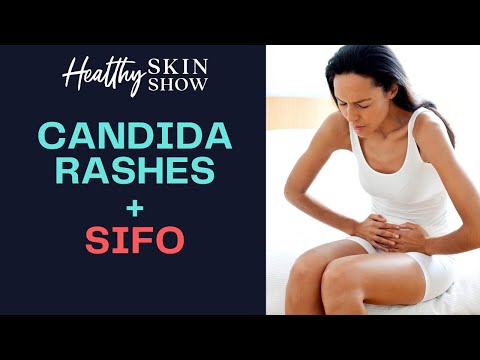 Candida Rashes + SIFO | Dr. Christine Maren