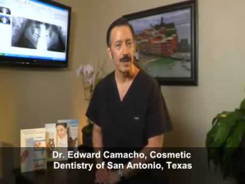 Cosmetic Dentist San Antonio Invisalign Dental Implants 210 493 9944 