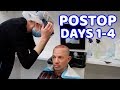 Postop Recovery : Hair Transplant
