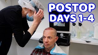 Postop Recovery : Hair Transplant