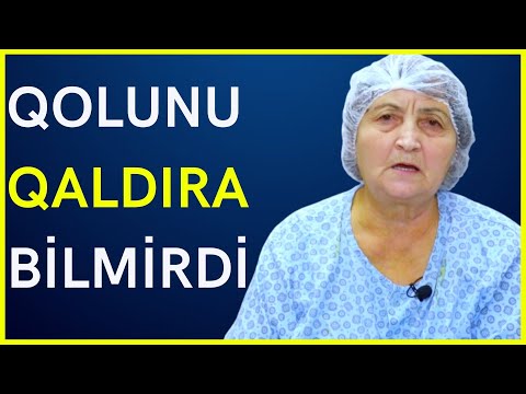 Video: Çiyin ağrısının diaqnozunun 3 yolu