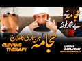 Cupping  cure to every disease  benefits of cupping therapy  molana tariq jamil 3 march 2021
