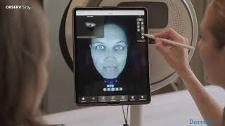 OBSERV 520x - The innovative Skin Analysis System