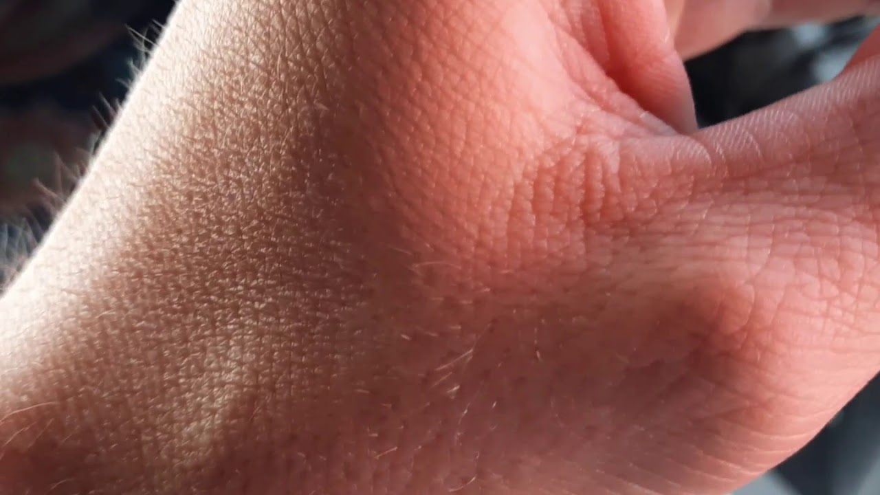 Ошибка abs ларгус