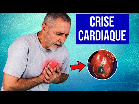 Vidéo: Dans une crise cardiaque massive ?