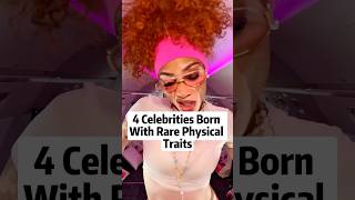 4 Celebrities Born with rare physical traits #celebrity #fyp #famous #hollywood #us