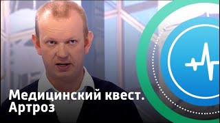 Медицинский квест. Артроз | Телеканал «Доктор»