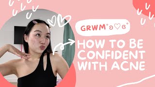 How to Be Confident with Acne | GRWM for an Event