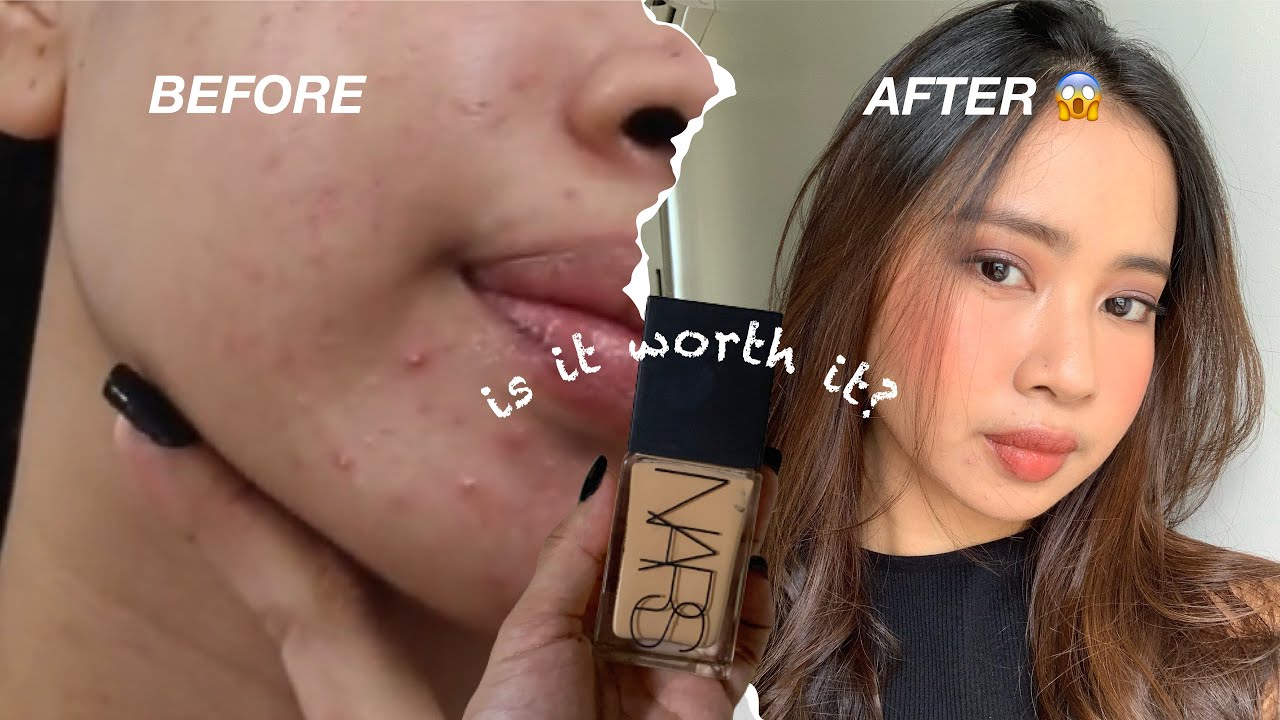 NARS LIGHT REFLECTING FOUNDATION REVIEW & WEAR TEST ON ACNE PRONE SKIN