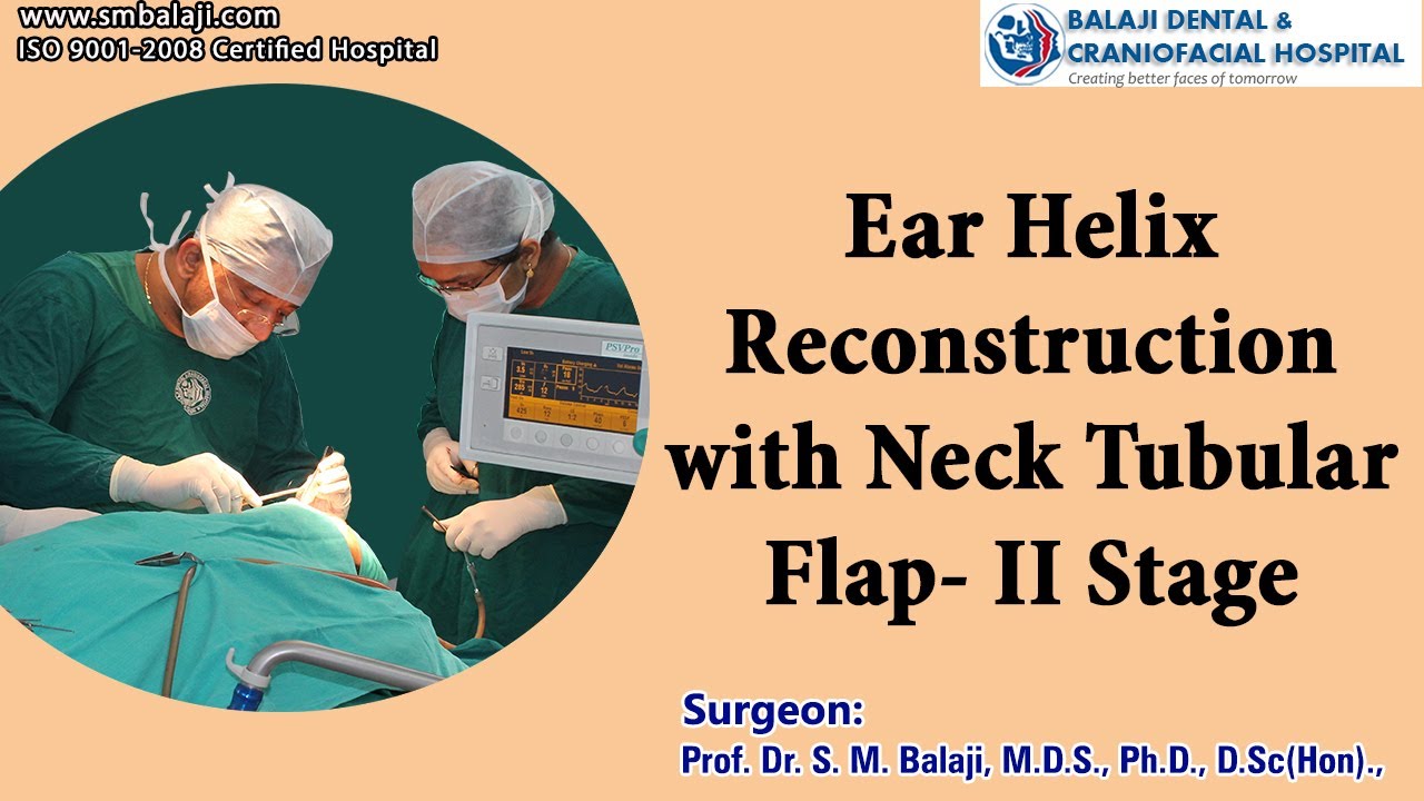Ear Helix Reconstruction with Neck Tubular Flap II Stage YouTube
