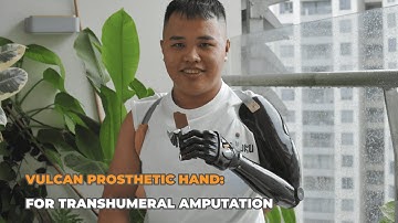 How To Use Myoelectric Hand | Vulcan Prosthetic Hand For Transhumeral Amputation