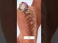 Get Rid Of Cracked Heels | Fair Feet Tips | Remove Suntan #crackedheels #repaircrackedheels #shorts