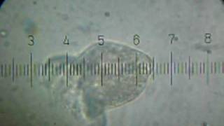20100626_204706_Protist.avi