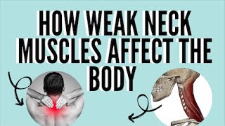 How Weak Neck Muscles Affect The Body