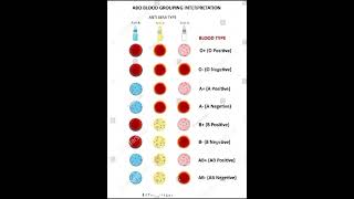Abo Blood Groping Interpretation.