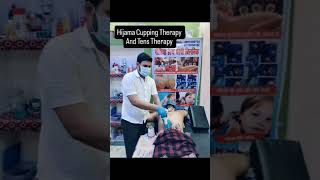 Hijama Cupping and Tens Therapy