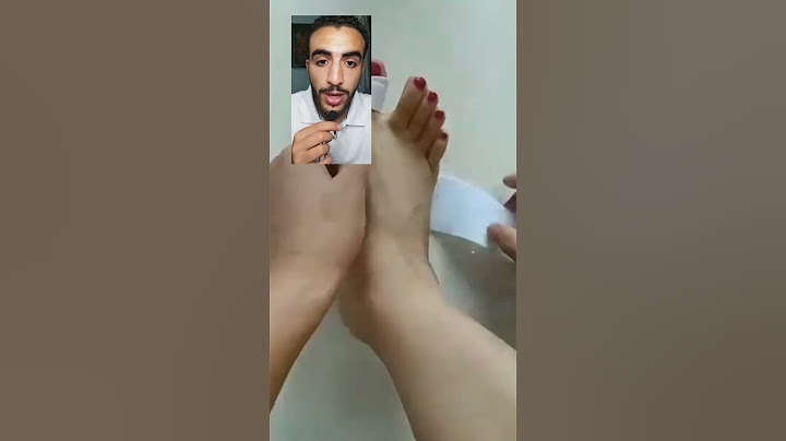 اداة هتعلاج صوابع رجليك بكل سهوله 😳❗