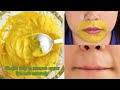 Upper lips unwanted hair remove Naturally and permanently At home|My charming secrets