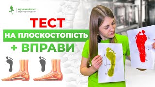 Тест На Плоскостопість. Топ 6 Вправ Для Профілактики Вдома | Кінезітерапія