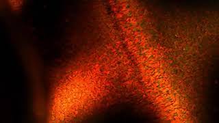MMF video-2 071318