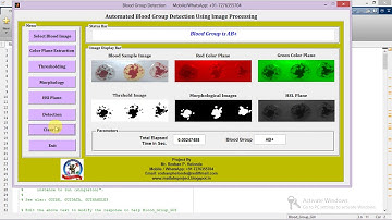 Blood Group Detection using matlab