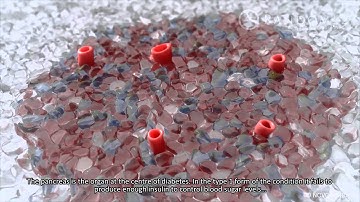 Random42 Science in Motion - Diabetes