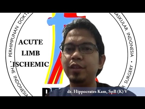 Acute Limb Ischemic - dr. Hippocrates Kam, SpB (K) V