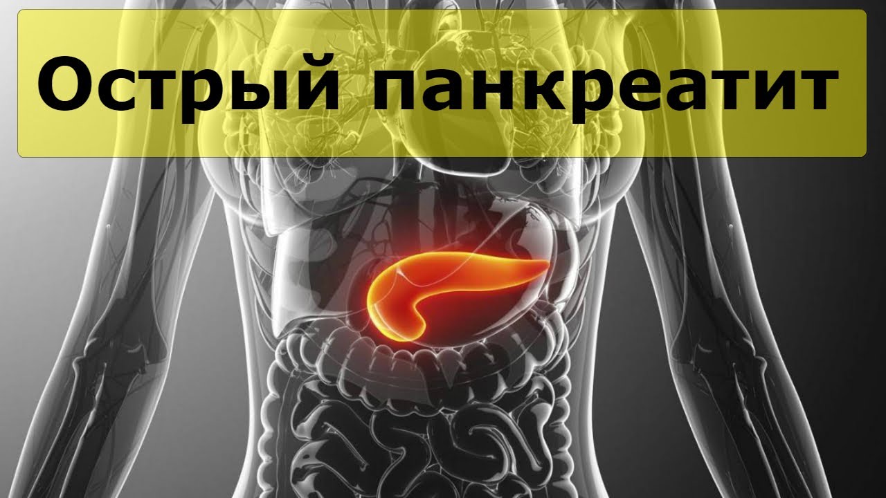 Панкреатит ли вест