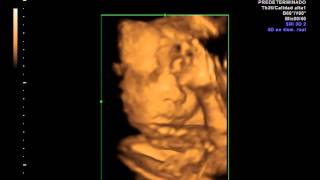 IMG 20130717 1 3 VolCine
