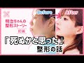 【整形】高嶋めいみ（明治ちゃん）の整形ストーリー 前編【コスプレイヤー】